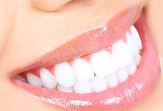 sbiancamento-denti-osimo