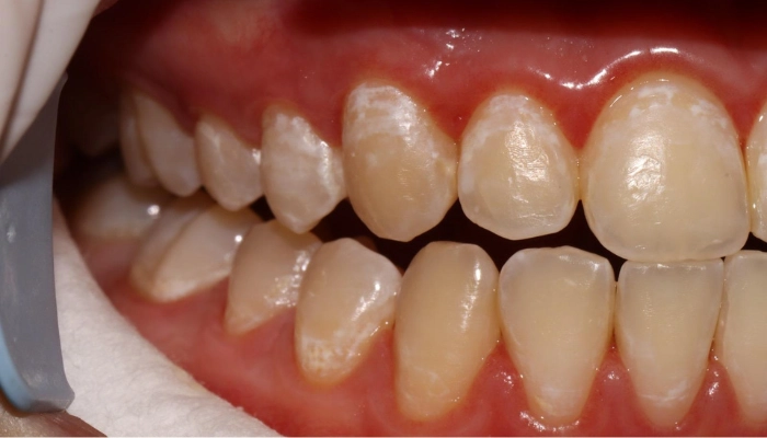 Dentista a Montelupone e Osimo