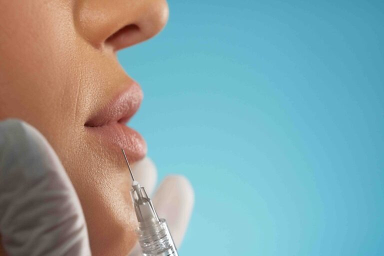 Blog 2 Come far durare di più il filler labbra